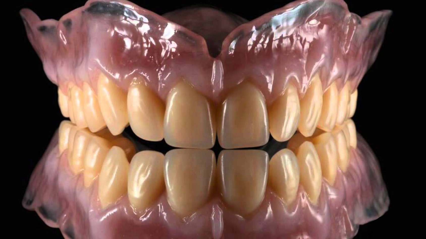 waarom niet fantoom verdwijnen Tandprothese – Tandvorm